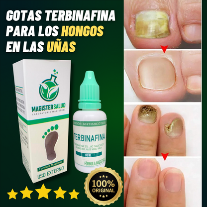 FRASCO DE TERBINAFINA PARA HONGOS EN LAS UÑAS